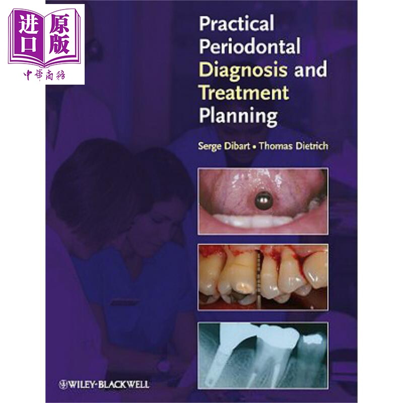 实用牙周诊断与治疗计划 Practical Periodontal Diagnosis And Treatment Planning Serge Dibart 英文原版【中商原版】wile