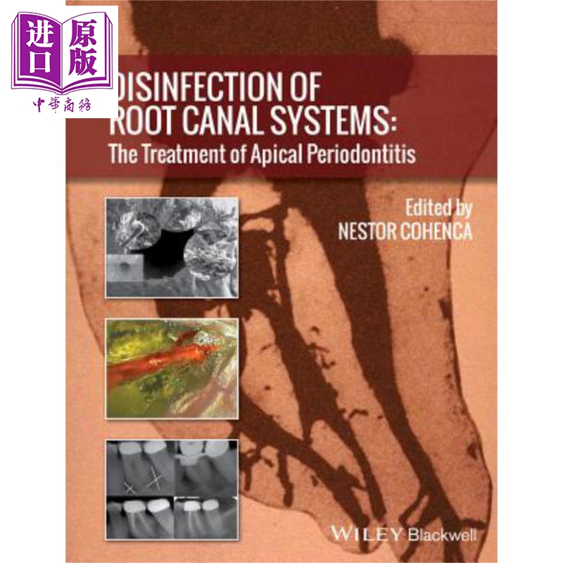 现货根管系统的消毒根尖周炎的治疗 Disinfection Of Root Canal Systems Nestor Cohenca英文原版【中商原版】wiley