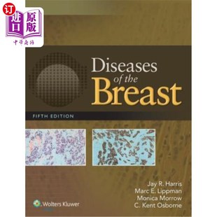海外直订Diseases Breast the 乳腺疾病5e