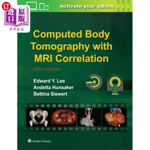 Tomography MRI Correlation 计算机体断层扫描与MRI相关 Body with 海外直订医药图书Computed