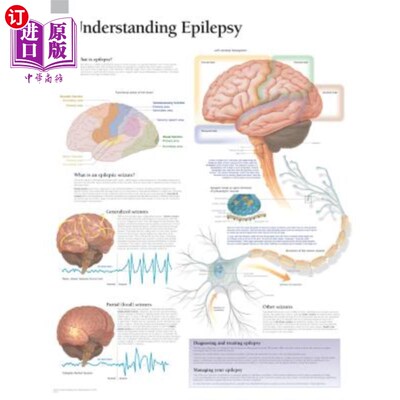 海外直订医药图书Understanding Epilepsy Chart: Laminated Wall Chart 了解癫痫图表:层压挂图