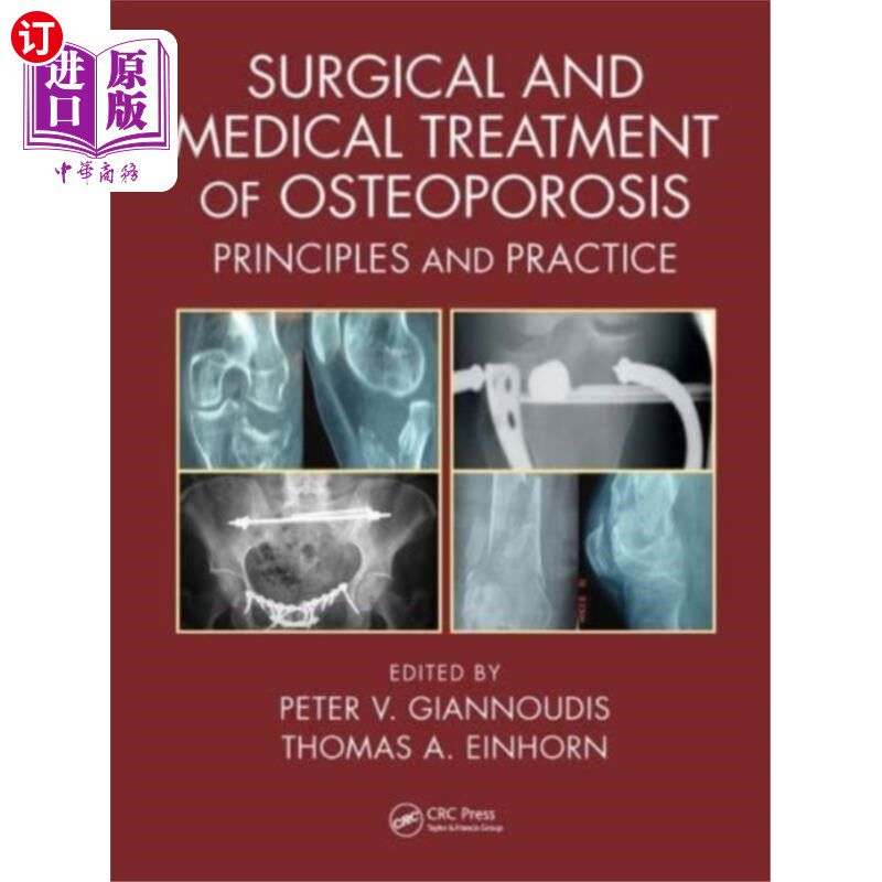 海外直订医药图书Surgical and Medical Treatment of Osteoporosis 骨质疏松症的外科和内科治疗