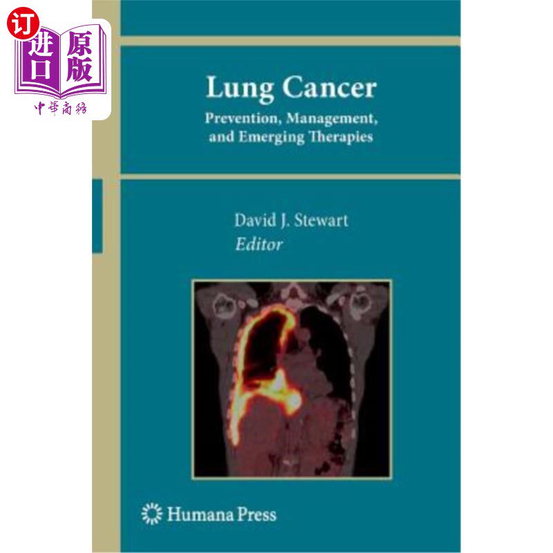 海外直订医药图书Lung Cancer:: Prevention, Management, and Emerging Therapies 肺癌:预防、管理和新兴疗法。