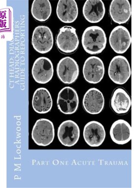 海外直订医药图书CT Head: DIAGNOSIS A Radiographers Guide To Reporting Part 1 Acute Trauma: Part  CT头部：诊断放射科