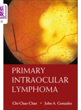 海外直订医药图书Primary Intraocular Lymphoma 原发性眼内淋巴瘤