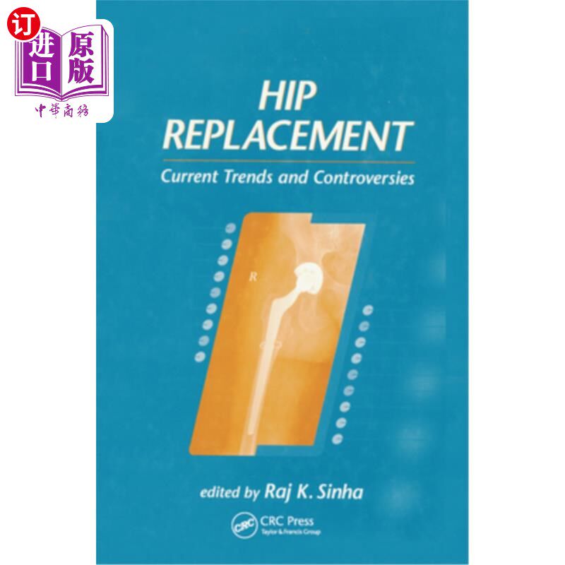 海外直订医药图书Hip Replacement: Current Trends and Controversies 髋关节置换:当前的趋势和争议