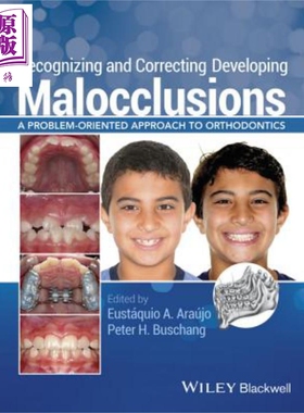 现货 畸齿矫正学问题 牙齿矫正 Recognizing and Correcting Developing Malocclusions 英文原版 Eustaquio Araujo【中商原版】