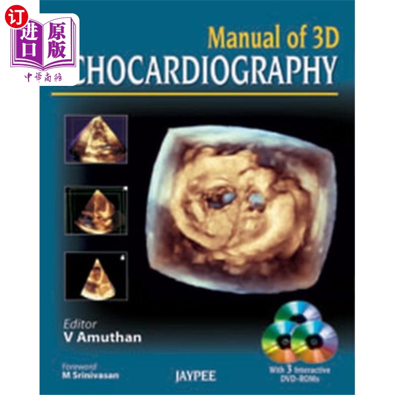 海外直订医药图书Manual of 3D Echocardiography三维超声心动图说明书-封面