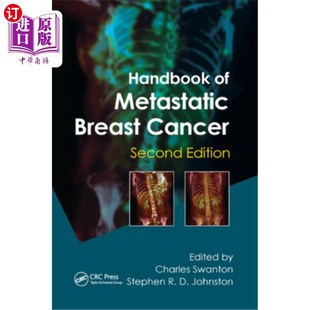 Cancer 海外直订医药图书Handbook Breast Metastatic 转移性乳腺癌手册