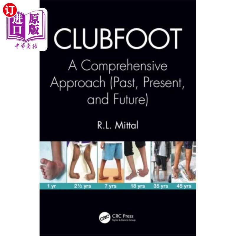 海外直订医药图书Clubfoot 马蹄内翻足