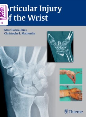 海外直订医药图书Articular Injury of the Wrist 手腕关节损伤