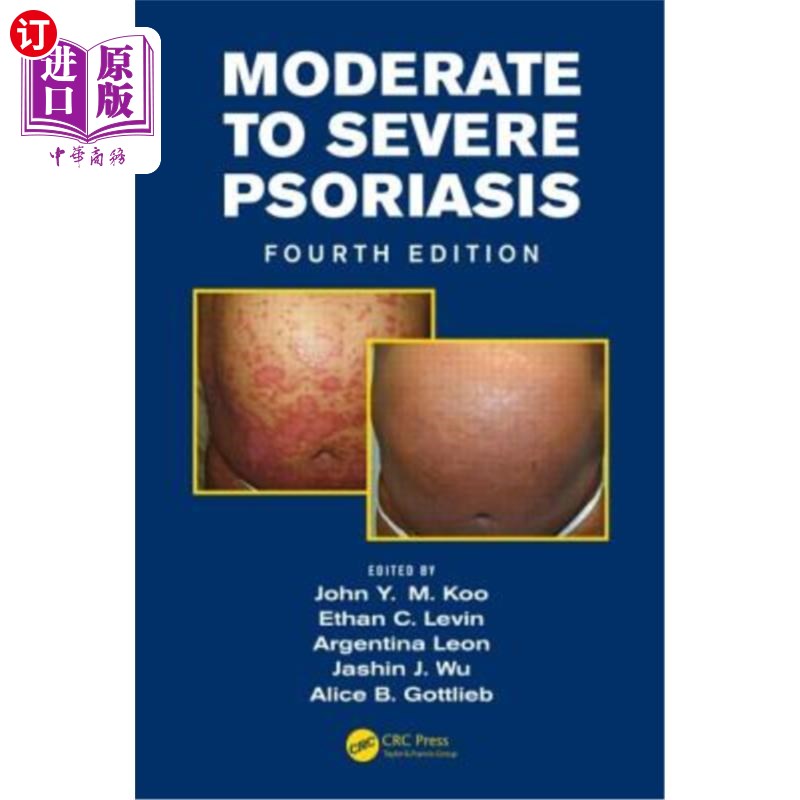 海外直订医药图书Moderate to Severe Psoriasis 中重度银屑病