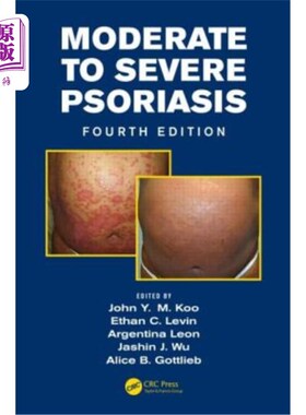 海外直订医药图书Moderate to Severe Psoriasis 中重度银屑病