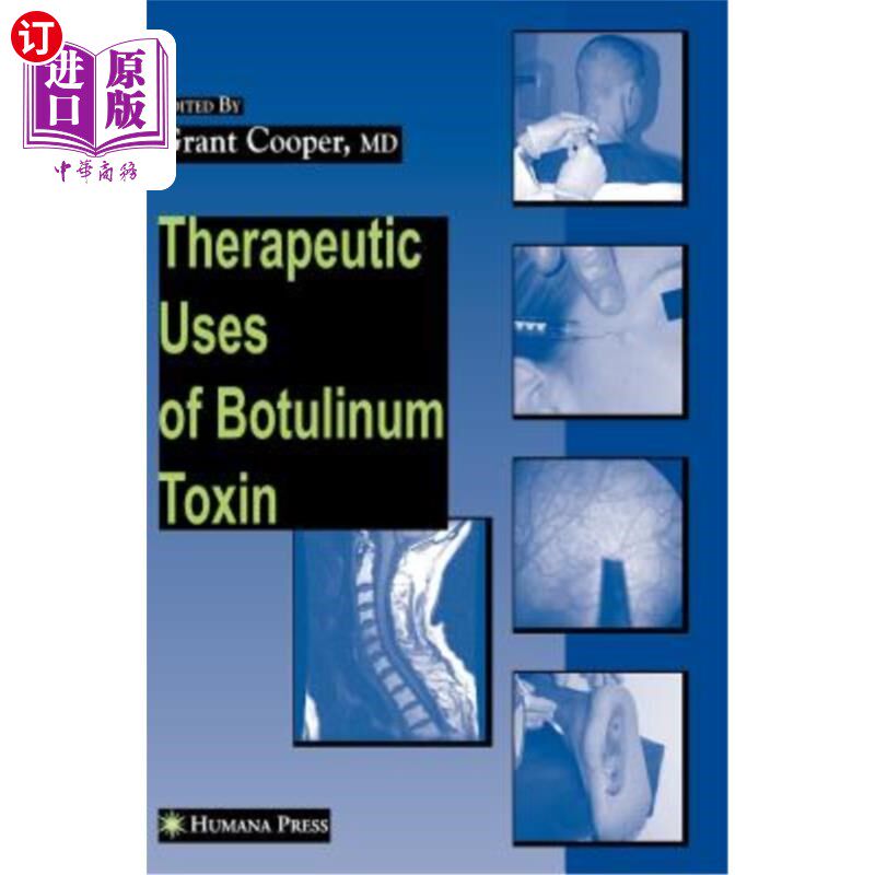 海外直订医药图书Therapeutic Uses of Botulinum Toxin 肉毒杆菌毒素的治疗用途
