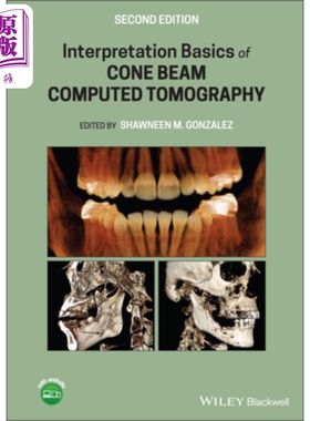 现货 锥束计算机断层扫描解释基础 Interpretation Basics Of Cone Beam Computed Tomography 英文原版 Shawneen Gon