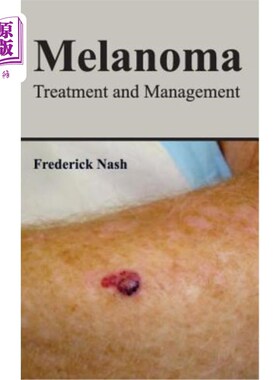 海外直订医药图书Melanoma: Treatment and Management 黑色素瘤的治疗与管理