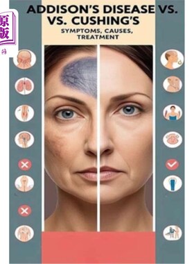 海外直订医药图书Addison's Disease vs. Cushing's - Symptoms, Causes, Treatment: Addison's disease 阿狄森氏病与库欣氏