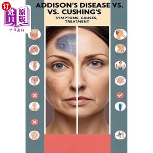 海外直订医药图书Addison's Disease vs. Cushing's - Symptoms, Causes, Treatment: Addison's disease 阿狄森氏病与库欣氏