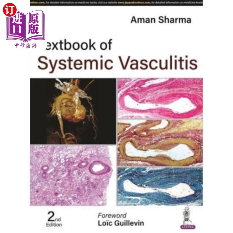 海外直订医药图书Textbook of Systemic Vasculitis 全身性血管炎教材