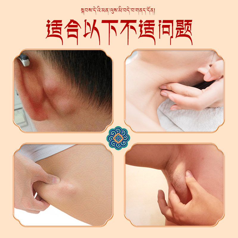 淋巴通络贴淋巴结消膏副乳淋巴贴膏 男女通用款脖子腋下副乳通络,运动/瑜伽/健身/球迷用品,其他运动护具,淘宝优惠券,粉丝福利购,淘宝优惠卷