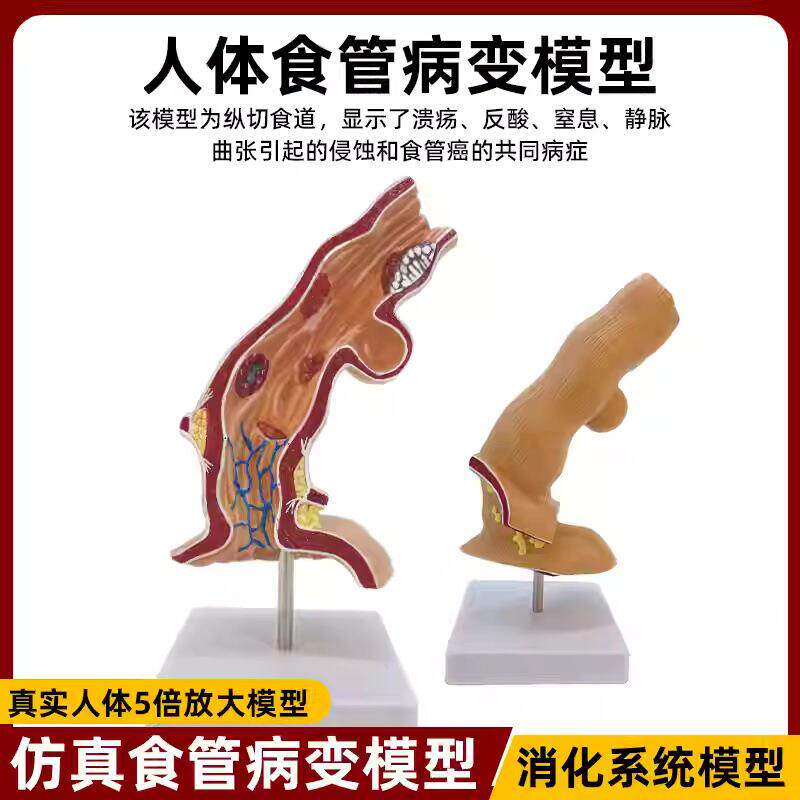 医用解剖病理模型食道消化系统科室食管教学器官医用解剖人体模型