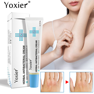 Eczema Cream Herbal Psoriasis Treat Antibacterial Dermatitis