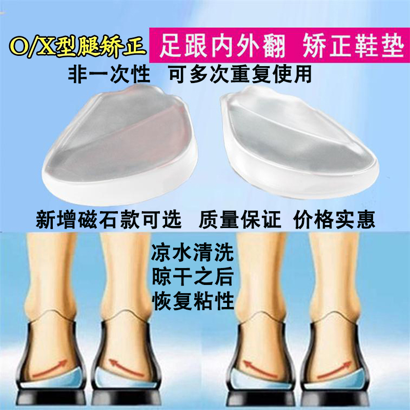 o型腿x型腿形矫正器腿型神器八字