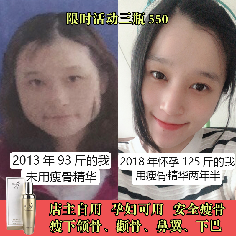 佑珍瘦颧骨价格 佑珍瘦颧骨图片 星期三