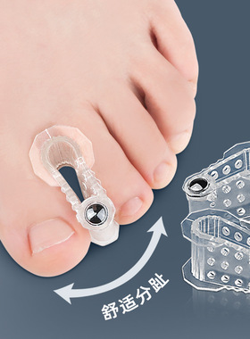 2个磁石分趾器拇指外翻矫形器重叠趾分离器大脚骨矫形器