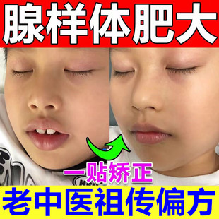 腺样体肥大中药贴儿童调理宝宝孩子张嘴呼吸睡觉鼻塞面容矫正器贴