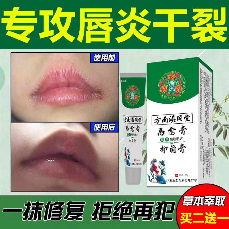 唇炎唇膏嘴唇干裂脱皮药医专用膏