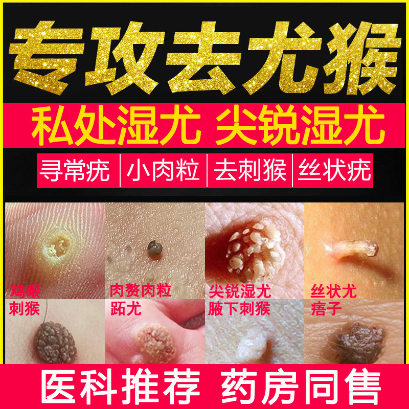 鬼臼霉毒素酊软膏去丝状犹尖锐湿