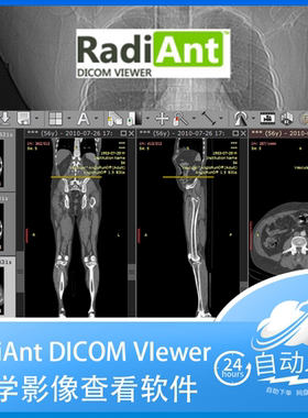 RadiAnt Dicom Viewer 2025中文dcm医学ct影像看片阅片工具永久版