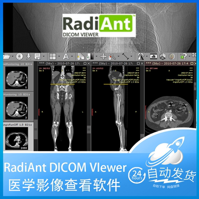 RadiAnt DICOM VIewer 2023中文版dcm医学ct影像看片软件永久激活