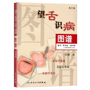 正版现货 望舌识病图谱(第2二版) 费兆馥顾亦棣编著 人民卫生出版社 图解舌诊 中医舌诊教材书籍 舌像,舌苔,舌象,望舌诊病彩色图解