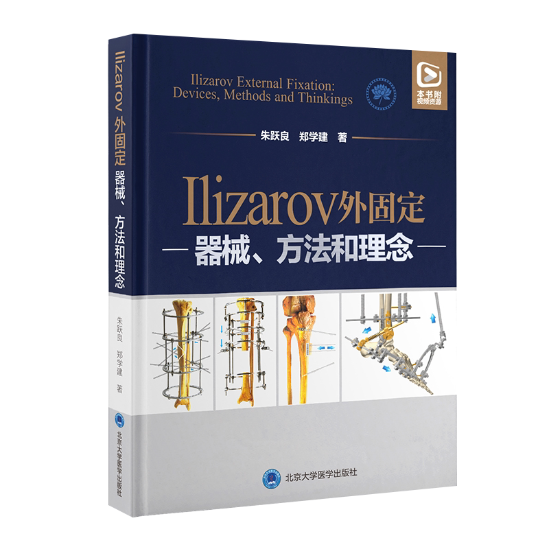 预售固定器械方法理念