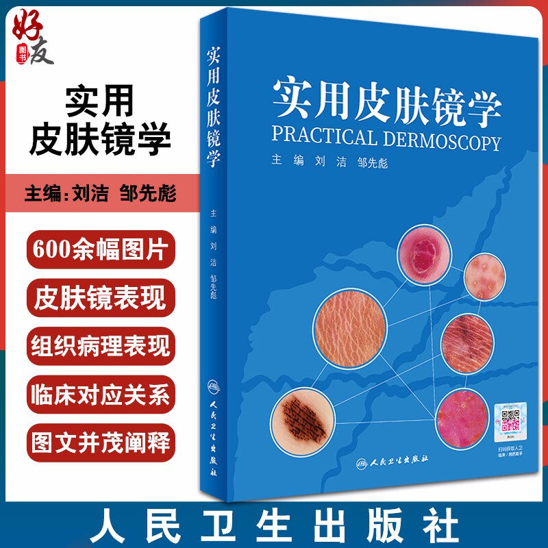 实用皮肤镜学 人卫刘洁邹先彪黑色素瘤脂溢性角化血管瘤银屑病黄褐斑协和皮肤镜图谱皮肤性病学人民卫生出版社9787117307871