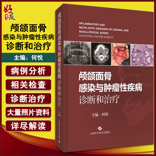 上海科学技术出版 颅颌面骨感染与肿瘤性疾病诊断和治疗 颅颌面骨常见病检查诊疗手术操作 口腔科学书籍 社9787547854884 何悦