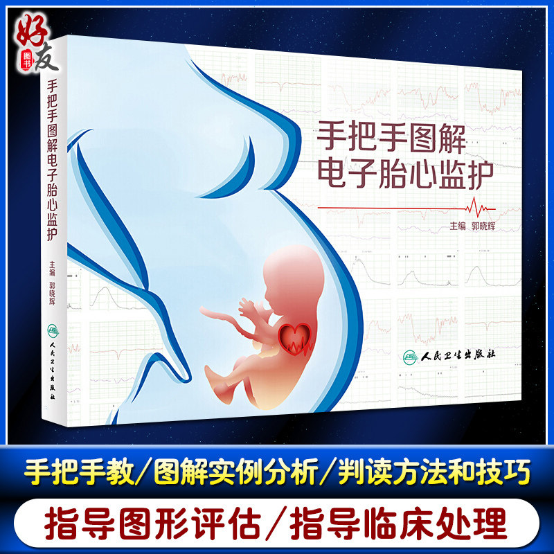 手把手图解电子胎心监护理论研究