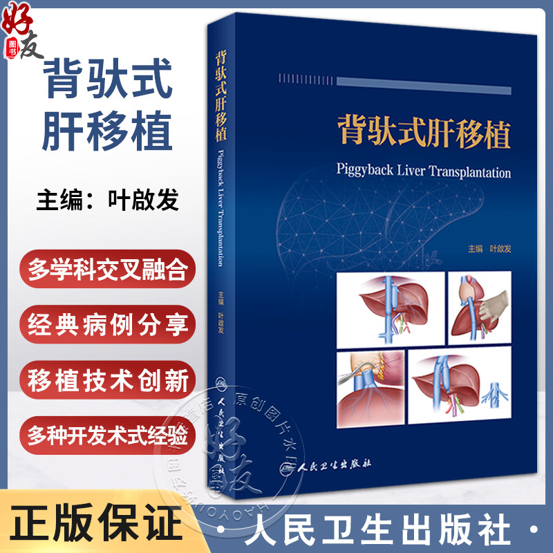 背驮式肝移植叶啟发主编