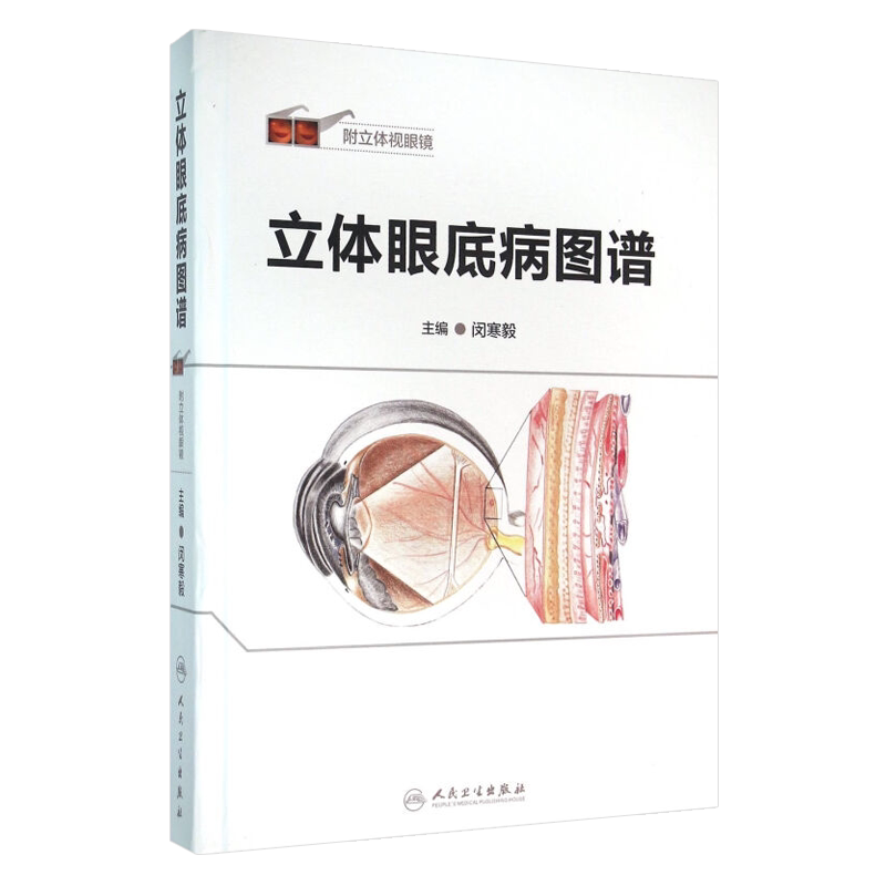 立体眼底病图谱 附立体视眼镜 闵寒毅主编 人民卫生出版社9787117212519