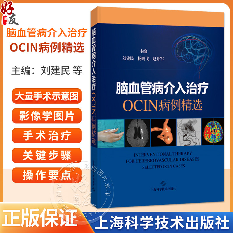 脑血管病介入治疗：OCIN病例精选 刘建民 杨鹏飞 赵开军 适用神经外科和神经内科及相关专业的临床医师、师生 上海科学技术出版社