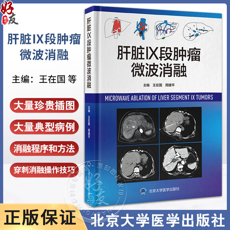 肝脏肝脏Ⅸ段肿瘤微波消融