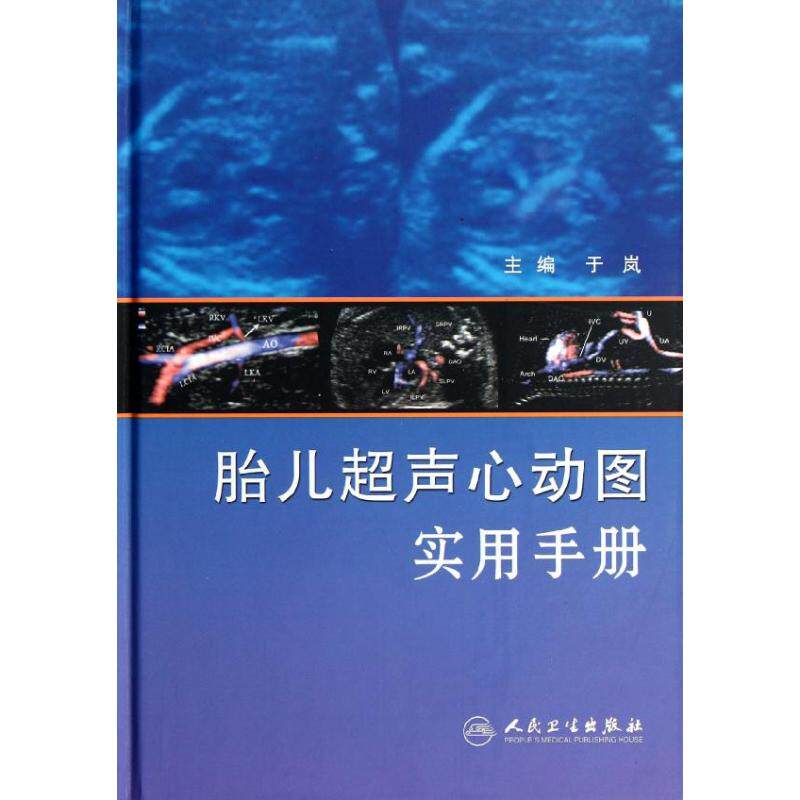 sy正版图书 胎儿超声心动图实用手册 妇产科学 9787117158336