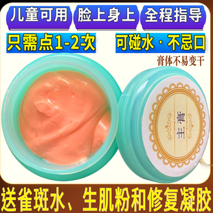 去除黑痣膏无痕祛点膏脸部雀斑不留疤点痦子黑点无痕神器专用药水