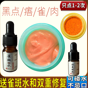 脸部点痣膏无痕药水正品雀斑去黑痣痦子刺猴不留疤美容院专用神器