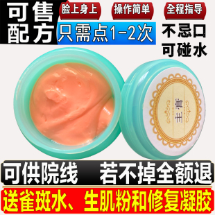 祛点膏修复痣无痕正品去脸部雀斑取志黑点专用点志药水点痦子神器