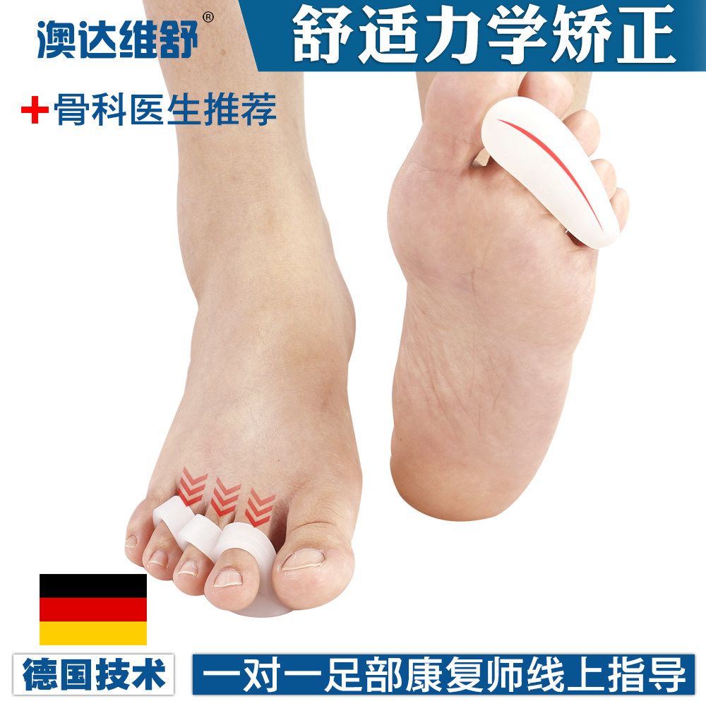 德国成人儿童锤状脚趾弯曲槌锤矫正器爪状V型形分趾重叠骨折硅胶