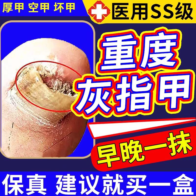 志修独特灰指甲胖东来真菌感染灰足部健康