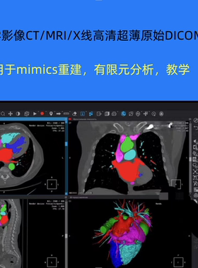 医学影像CT/DR/MRI/X光片磁共振原始DICOM数据资料素材代查找